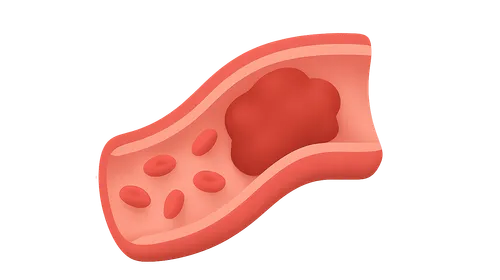 Hemodynamic Disorders