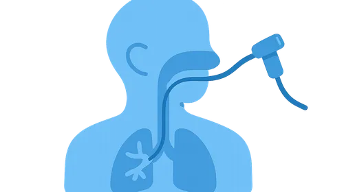 Anesthesia for Bronchoscopy