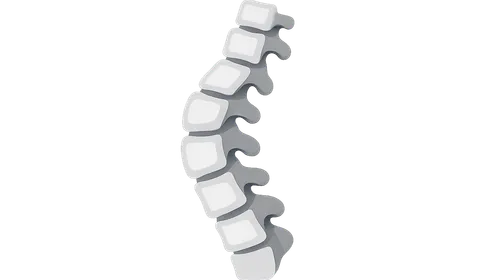 Spinal Deformities