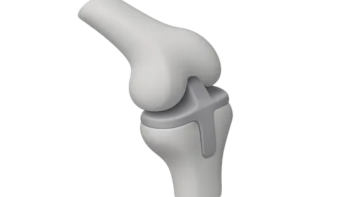 Orthopedic Biomechanics