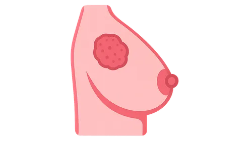 Breast cancer staging and surgical management