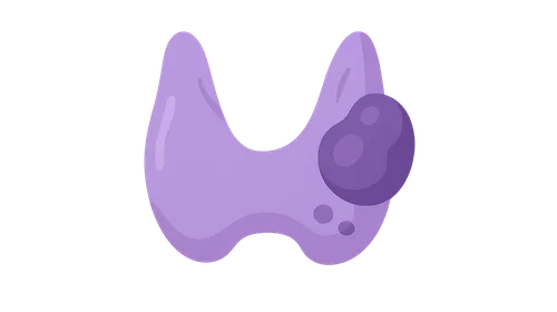 Thyroid nodules and cancer