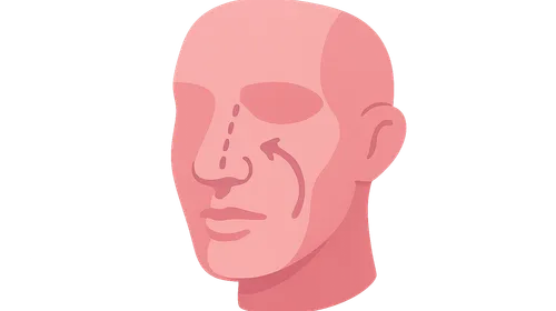 Breast Reconstruction