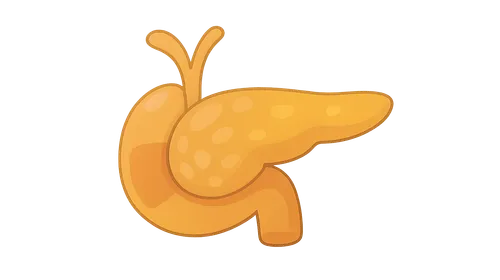 Acute pancreatitis management