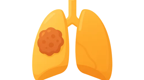 Occupational Cancers