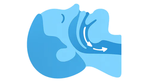 Pathophysiology of Sleep-Disordered Breathing