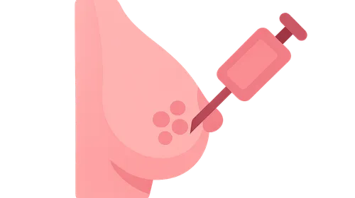 Breast biopsy techniques