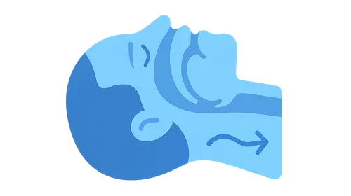 Sleep-Disordered Breathing