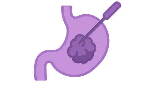 Minimally Invasive Approaches in Cancer Surgery