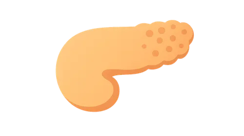 Diabetes mellitus pathology