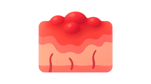 Chronic inflammation