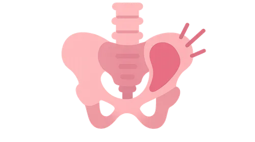 Musculoskeletal Causes of Pelvic Pain