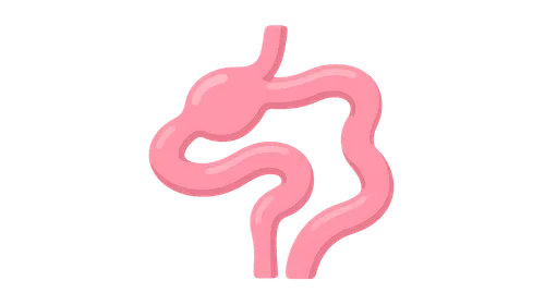 Intestinal Atresia and Stenosis