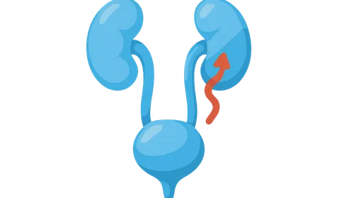 Vesicoureteral Reflux