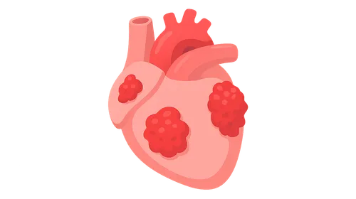 Rheumatic Heart Disease