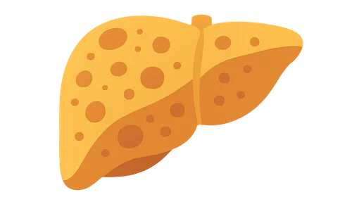 Viral hepatitis (A, B, C, D, E)