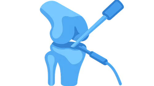 Arthroscopic Techniques