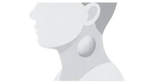 Neck Masses Evaluation