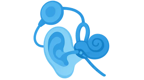 Cochlear Implantation