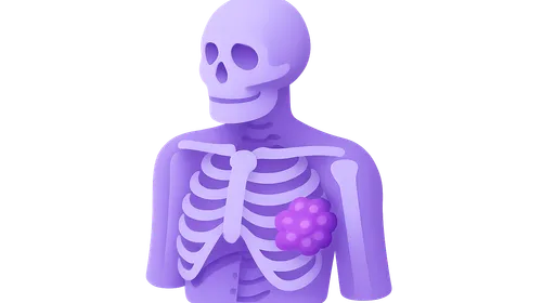 Cancer Pain Management