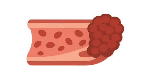 Hypercoagulable states