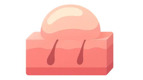 Management of Autoimmune Bullous Diseases