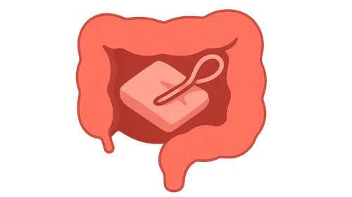 Retained surgical items