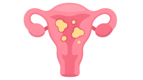 Sexually Transmitted Infections