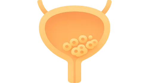 Urinary Tract Cytology
