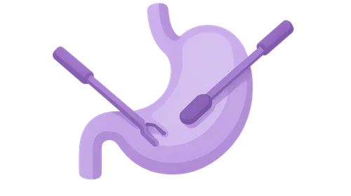 Minimally invasive oncologic surgery