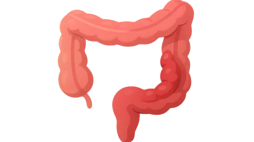 Vascular Disorders of Intestine