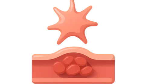 Platelets and Hemostasis