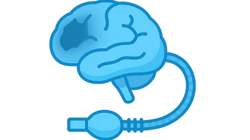 Anesthesia for Traumatic Brain Injury