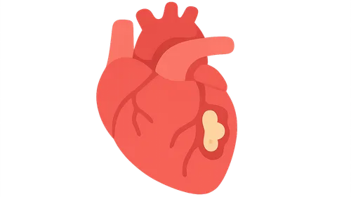 Ischemic Heart Disease Imaging