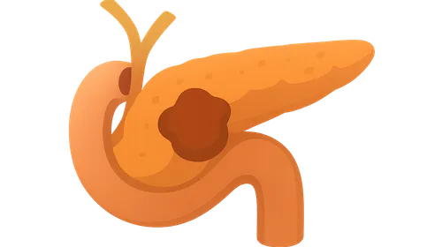 Whipple procedure indications