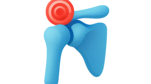 Pain Management in Rehabilitation