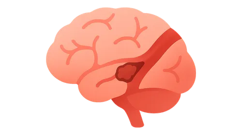 Vascular Diseases in Specific Organs