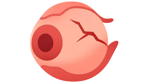 Classification of Ocular Trauma