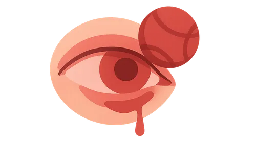 Sports-Related Eye Injuries