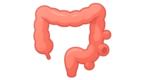 Diverticular disease