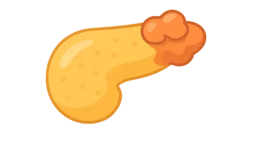 Autoimmune pancreatitis