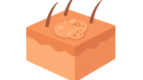 Opportunistic Fungal Infections