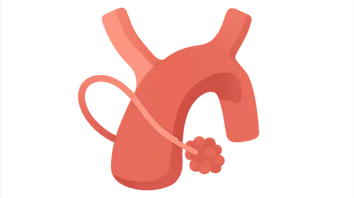 Embolization Procedures