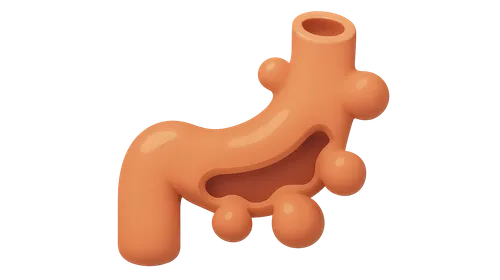 Diverticular Disease