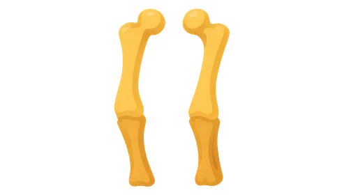 Vitamin D deficiency and rickets