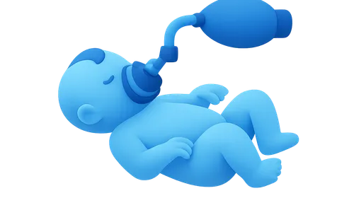 Neonatal Resuscitation