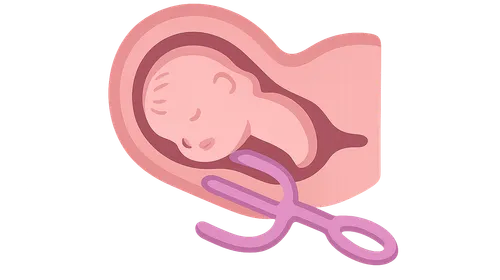 Operative vaginal delivery