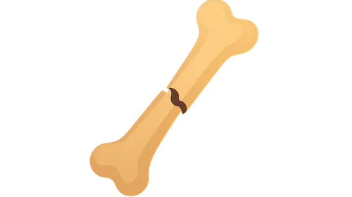 Nonunion and Malunion