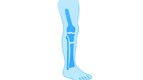 Pediatric orthopedic emergencies