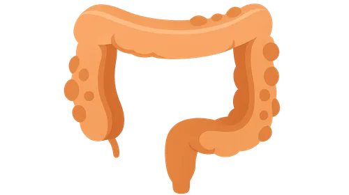 Diverticular Disease